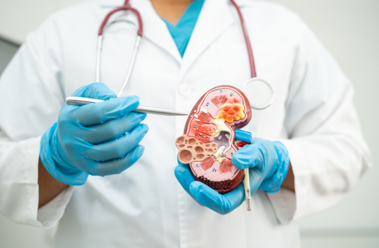 Kidney Stone Management​